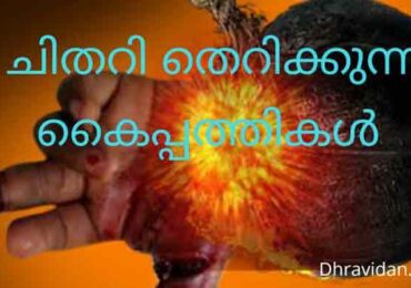 ചിതറി തെറിക്കുന്ന കൈപ്പത്തികൾ