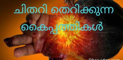 ചിതറി തെറിക്കുന്ന കൈപ്പത്തികൾ